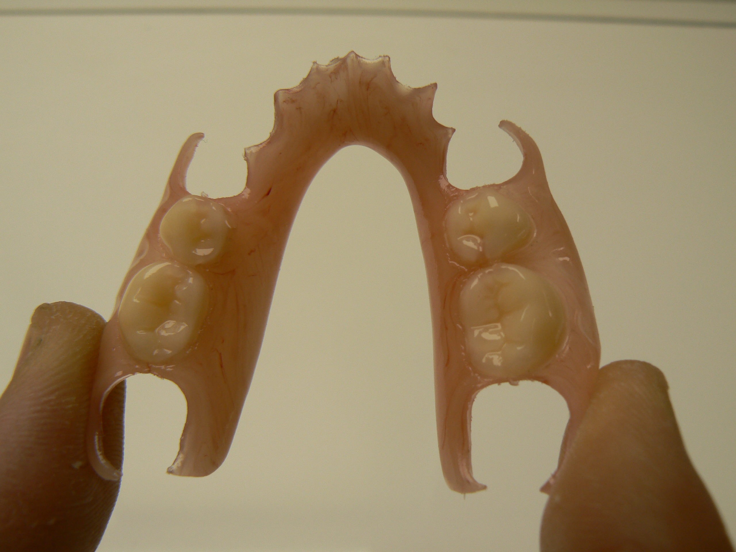 Thermoplastie pressing dental PN Prothèse